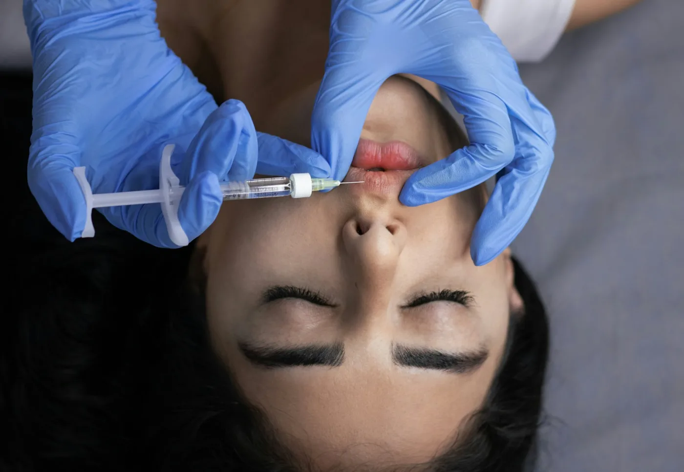 Tropokolagen – iniekcja naturalnego kolagenu w skórę twarzy wykonywana przez kosmetologa w rękawiczkach w salonie Beauty Skin Bielsko-Biała